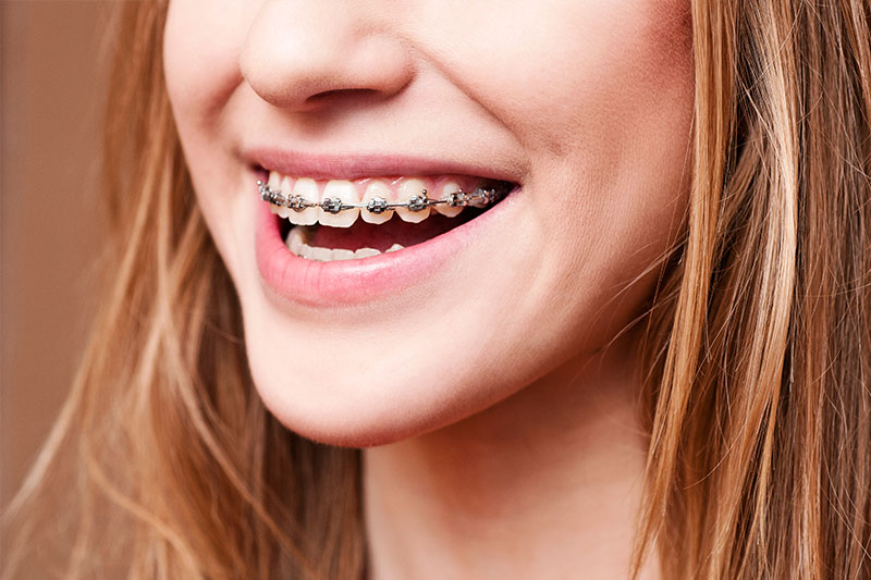 Orthodontics in Plainwell